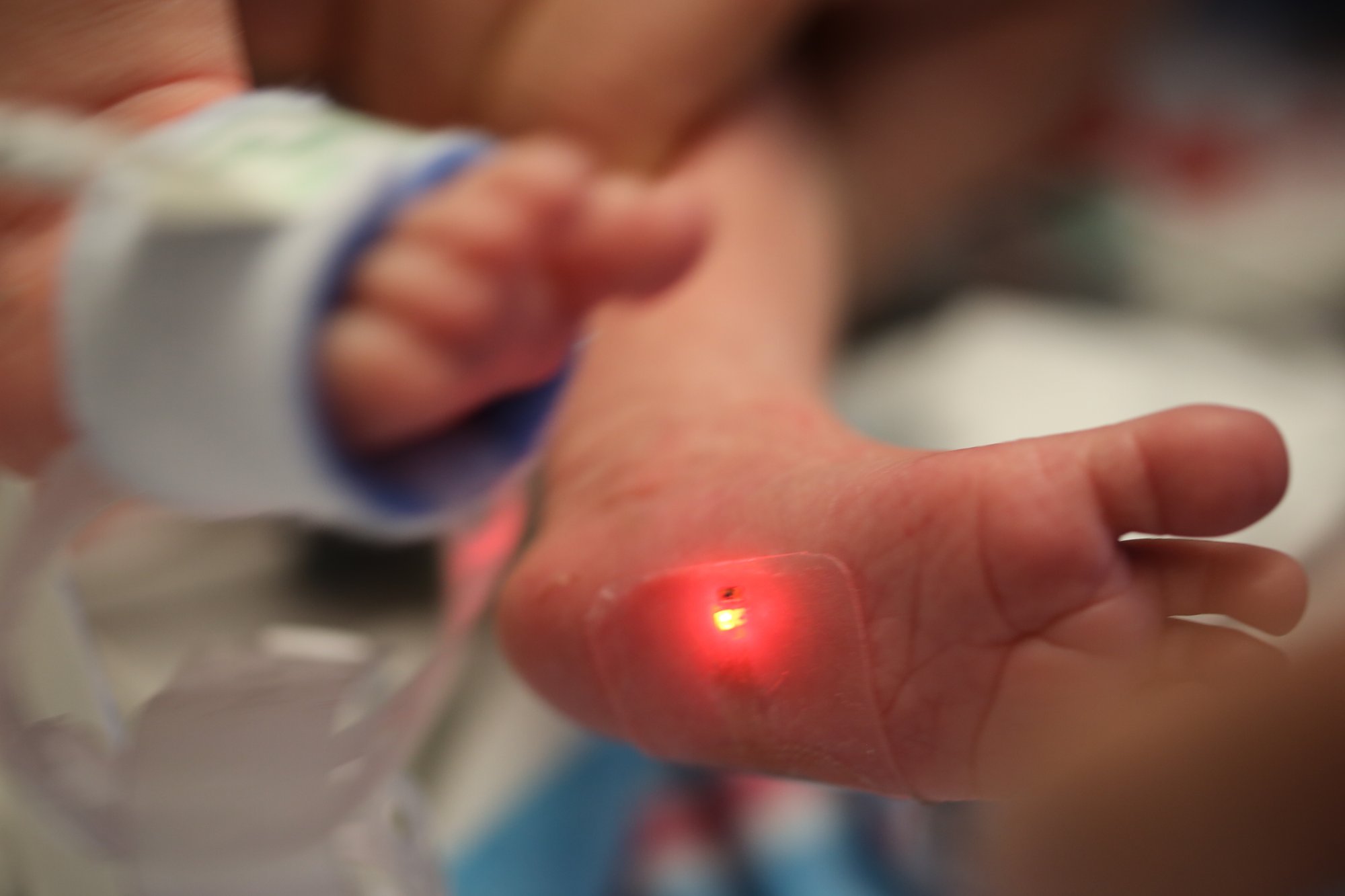 This 2019 photo provided by Northwestern University shows a soft, flexible wireless sensor applied on a foot of a family's baby, who is involved in the clinical trial at Ann & Robert H. Lurie Children's Hospital of Chicago. This kind of sensor could replace the tangle of wire-based sensors that currently monitor babies in hospitals' neonatal intensive care units. (Northwestern University via AP)