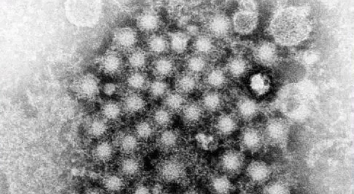 Rise in Hepatitis A cases prompts Florida to declare public health emergency - Wink News thumbnail