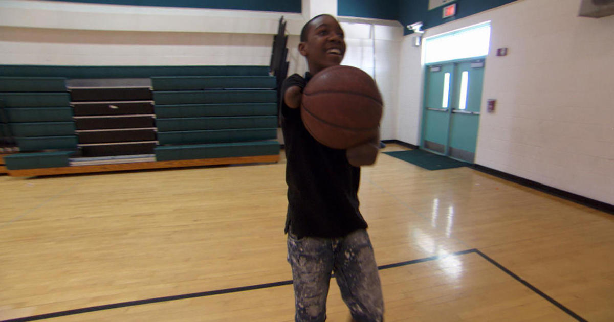 Armless basketball player makes his play for another team. (Credit: CBS News)