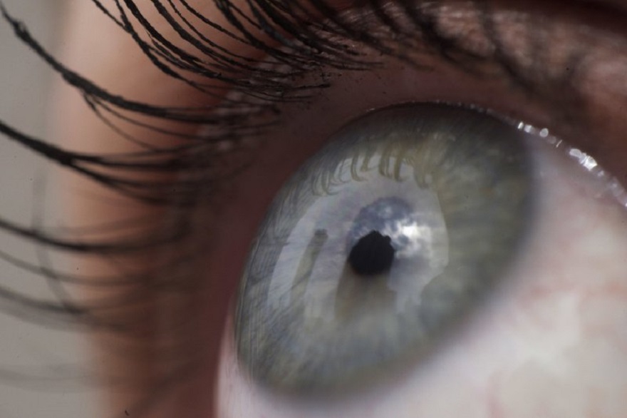 FILE - This April 12, 2018 file photo shows the eye of a woman in New York. Patients are about to be enrolled in the first study to test gene editing inside the body to try to cure an inherited form of blindness. People with the disease have healthy eyes but lack a gene that converts light into signals to the brain that enable sight. (AP Photo/Patrick Sison, File)