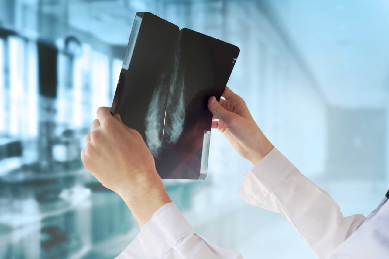 Google says it has developed an artificial intelligence system that can detect the presence of breast cancer more accurately than doctors. (Credit: Shutterstock)