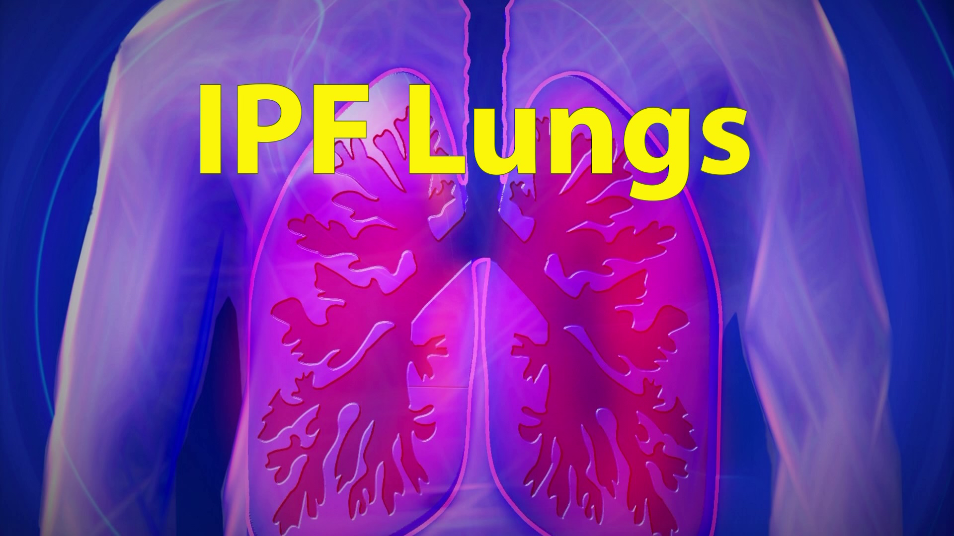 researchers-continue-to-study-idiopathic-pulmonary-fibrosis