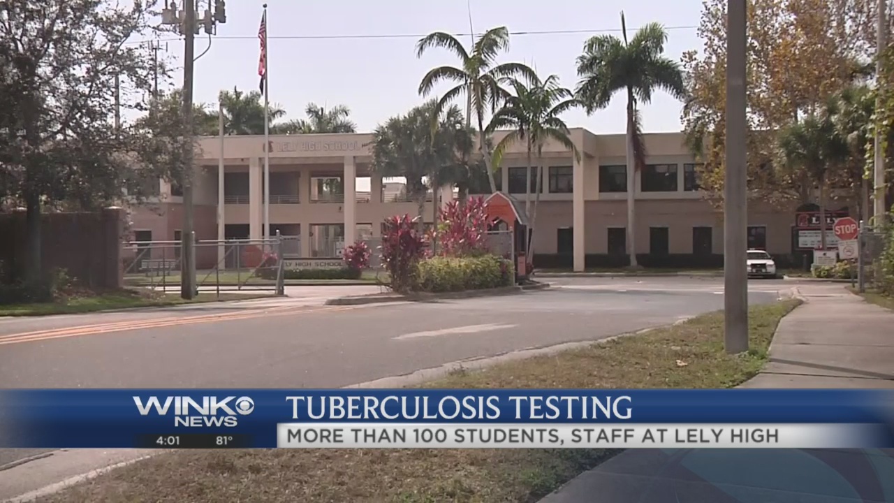 Lely High students and staff tested for TB